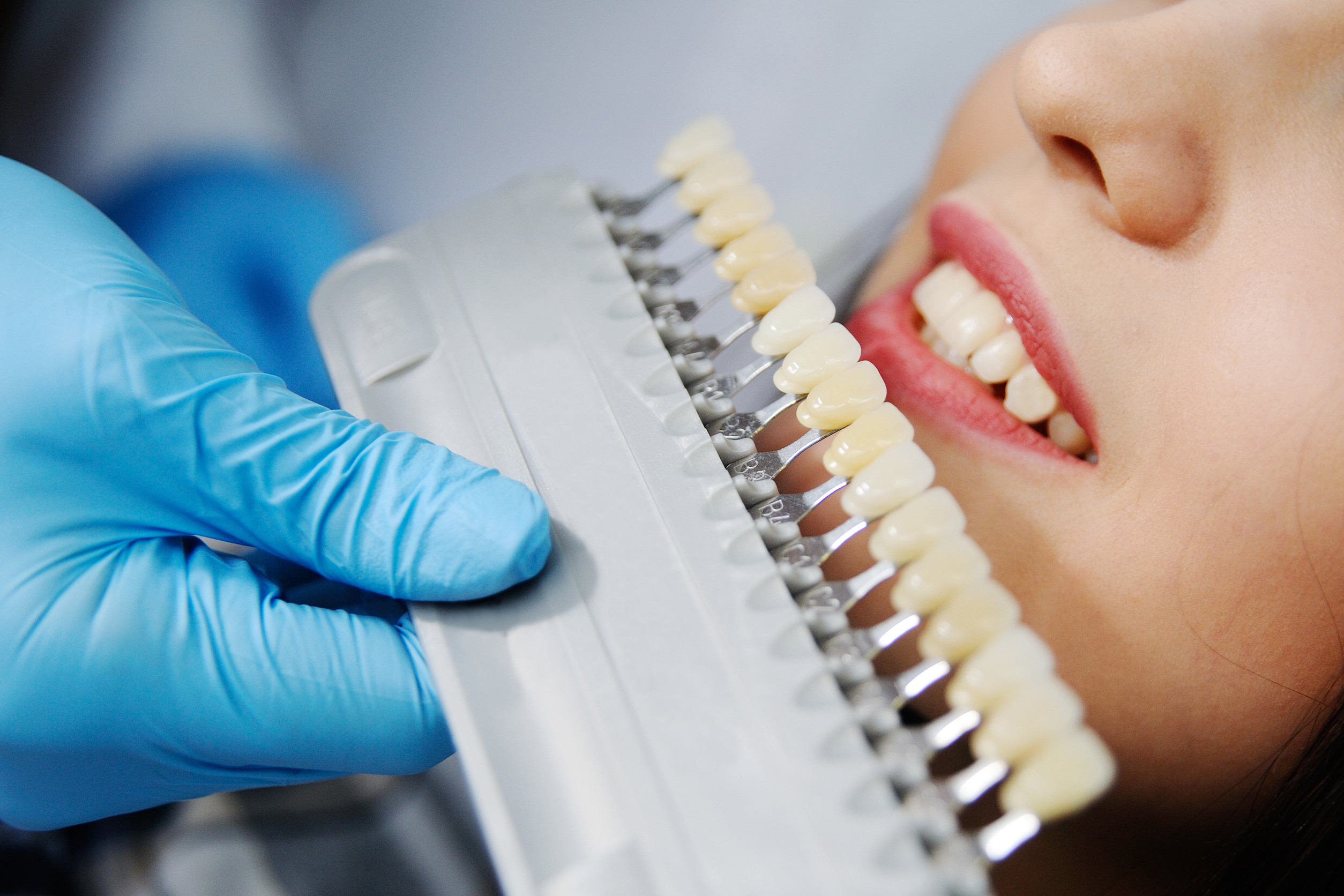 choose the color of the teeth. Girl in dentist's chair